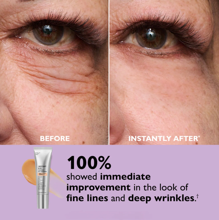 Instant Eye Tightener