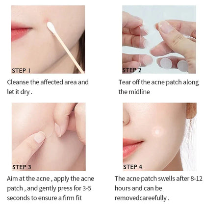 Invisible Acne Patch™ (72 Pcs)