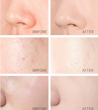 GOLD PEEL OFF MASK